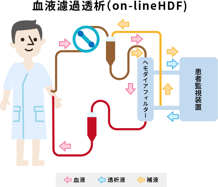 科学家改变沸石的特性以改善血液透析